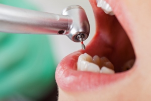 Close up picture of dental drill in young female patient\'s mouth