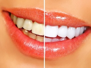 Rockville Dentist Pristine Smiles Bethesda Dentist